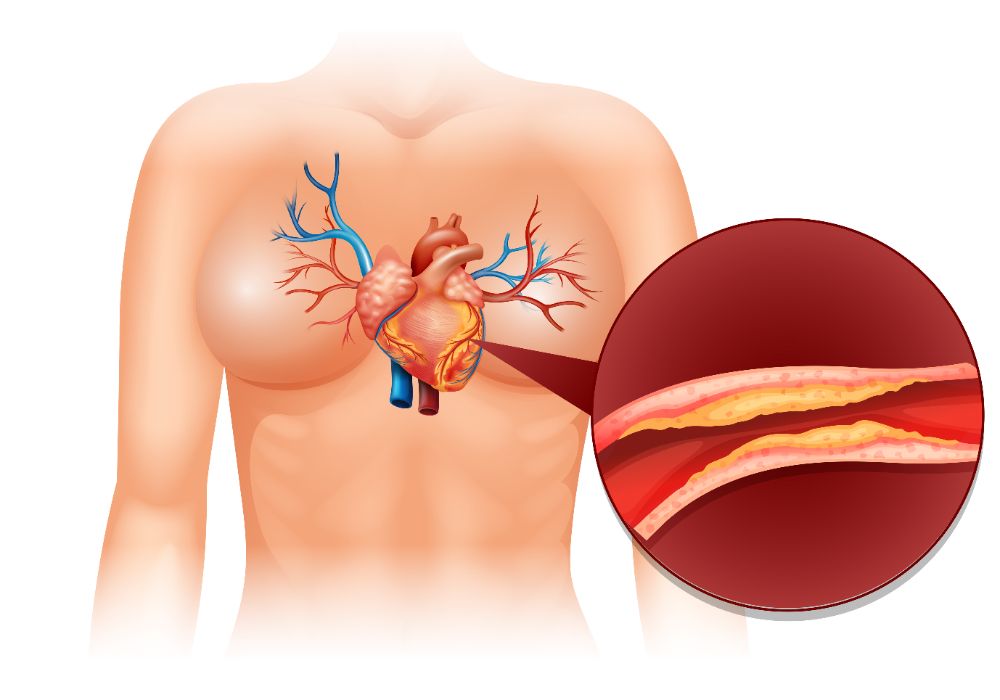 cholesterol testing hollinswood telford